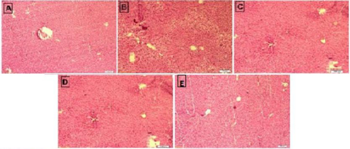 The hepatoprotective effects of sitagliptin against cyclophosphamide-induced hepatotoxicity in rat.