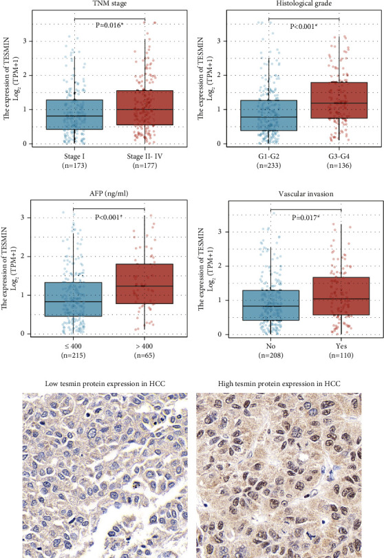 Clinical Significance and Functional Insights of Tesmin in Hepatocellular Carcinoma.