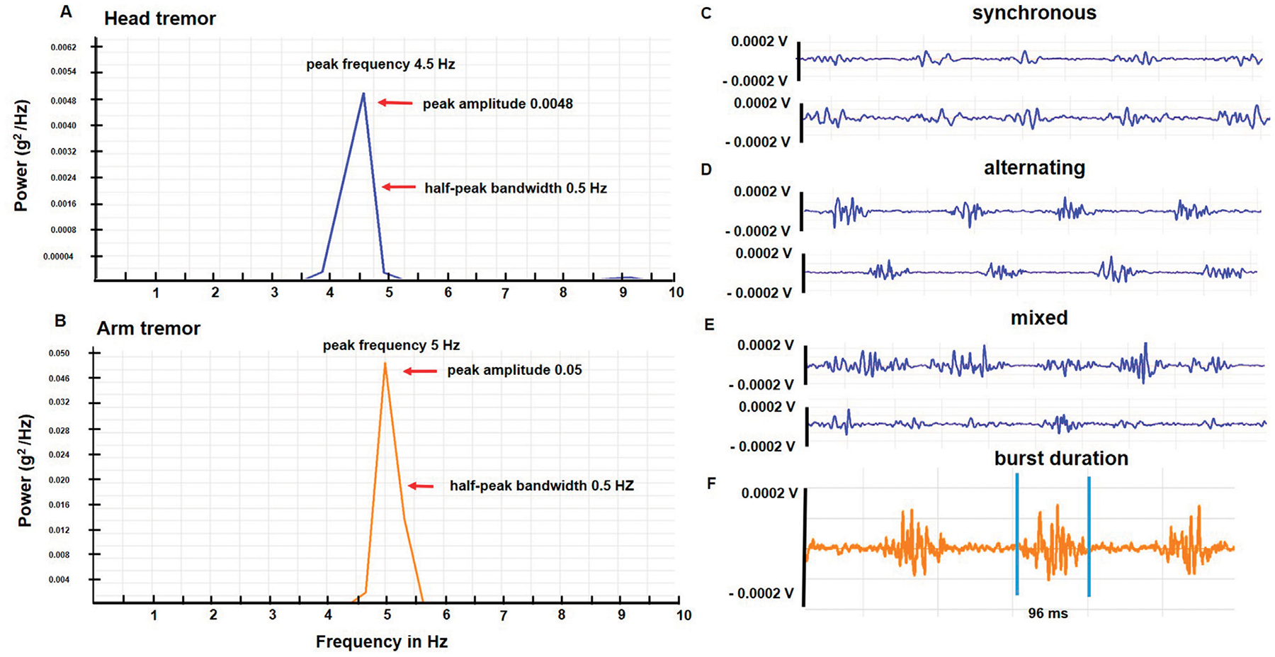 Clinical and physiological characteristics of tremor in a large cohort of focal and segmental dystonia.