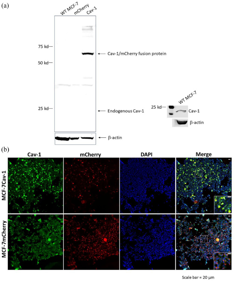 Caveolin-1, a Determinant of the Fate of MCF-7 Breast Cancer Cells.