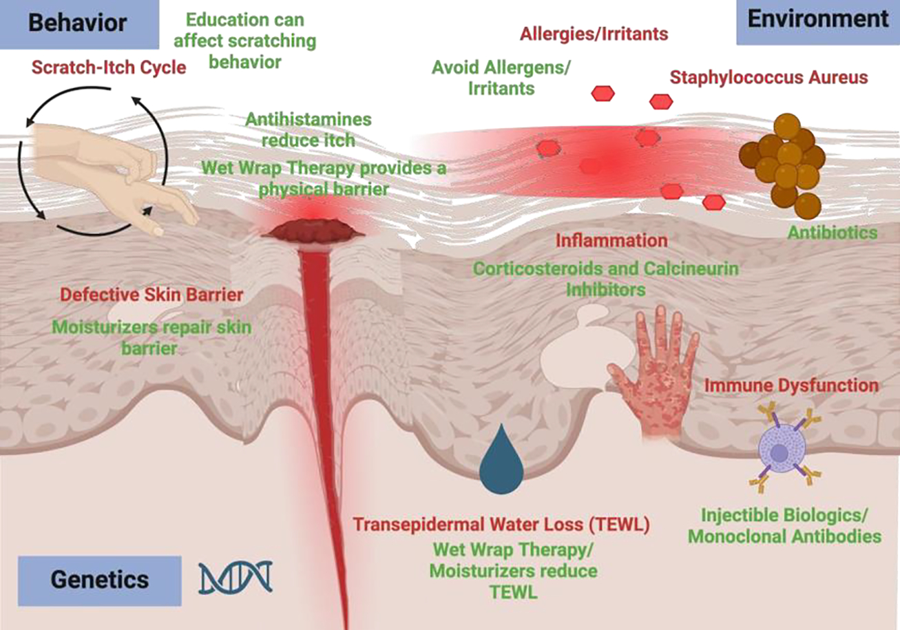 Exploring the Complexities of Atopic Dermatitis: Pathophysiological Mechanisms and Therapeutic Approaches.
