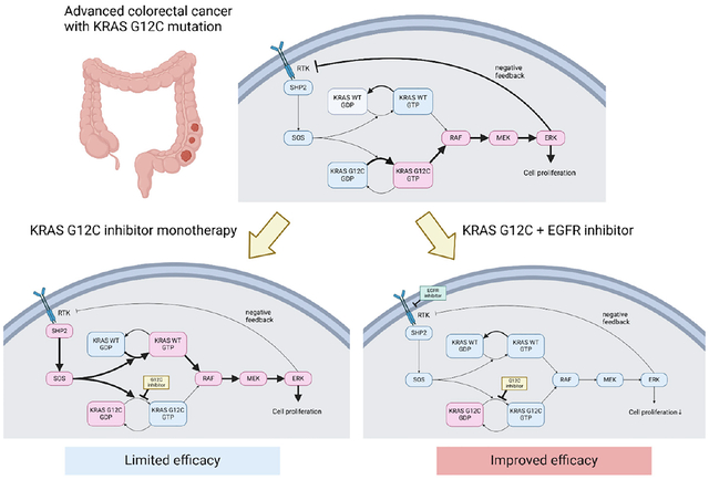 Combining EGFR and KRAS G12C Inhibitors for KRAS G12C Mutated Advanced Colorectal Cancer.