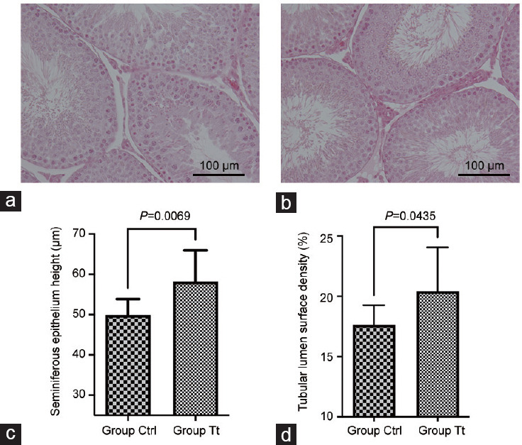 What is the effect of Tribulus terrestris on testicular morphology and sperm production? An experimental study in the rat model.