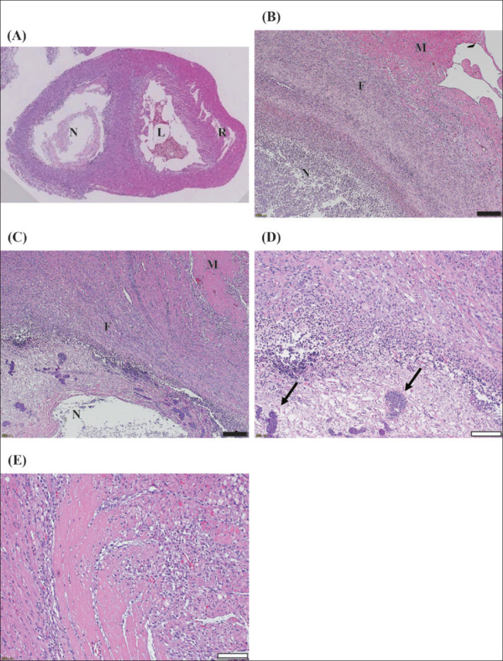 Granulomatous Myocarditis Caused by Candida Spp Infection in a Spontaneously Diabetic Torii Rat.