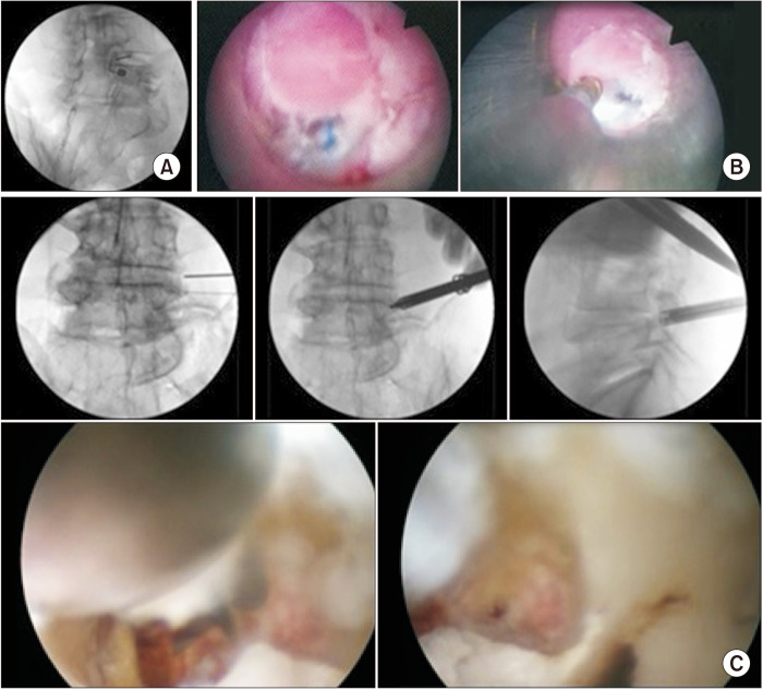 Facet joint disorders: from diagnosis to treatment.