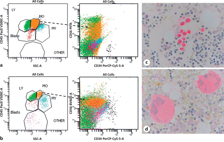 NPM1-Mutated Acute Myeloid Leukemia: Recent Developments and Open Questions.