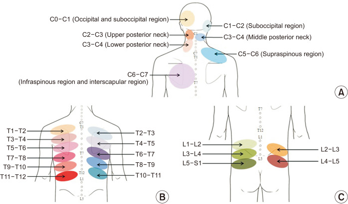 Facet joint disorders: from diagnosis to treatment.