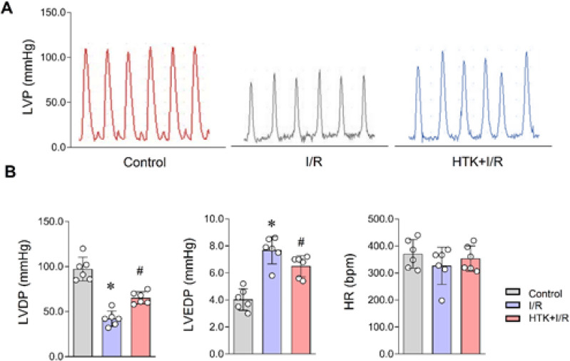 Melatonin enhanced the cardioprotective effects of HTK solution on Langendorff-perfused mouse hearts subjected to ischemia/reperfusion.