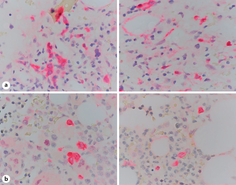 NPM1-Mutated Acute Myeloid Leukemia: Recent Developments and Open Questions.