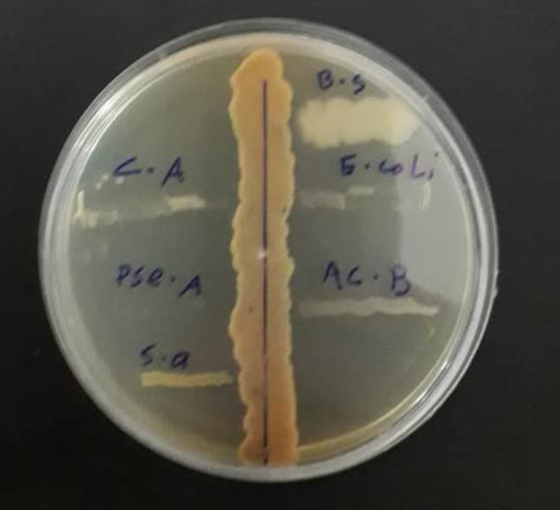 Evaluation of the Cytotoxicity of Secondary Bioactive Compounds Produced by <i>Streptomyces</i> in Soil against a Colon Cancer Cell Line.