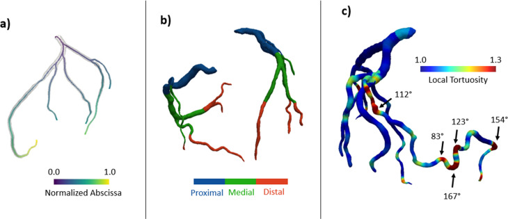 A fully automated deep learning approach for coronary artery segmentation and comprehensive characterization.