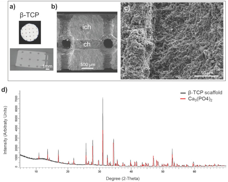 Three-dimensional in vitro model of bone metastases of neuroblastoma as a tool for pharmacological evaluations.