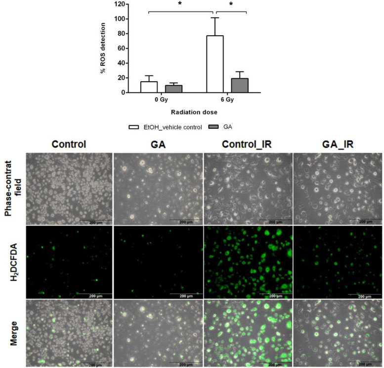 Cytoprotective Effect of Gallic Acid against Injuries Promoted by Therapeutic Ionizing Radiation in Preosteoblast Cells.