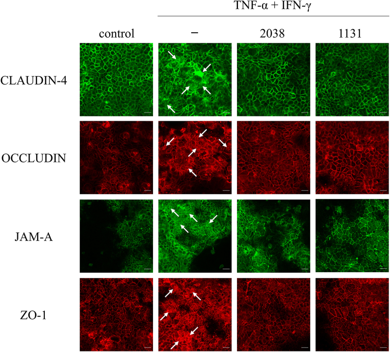 Yogurt starter strains ameliorate intestinal barrier dysfunction via activating AMPK in Caco-2 cells.