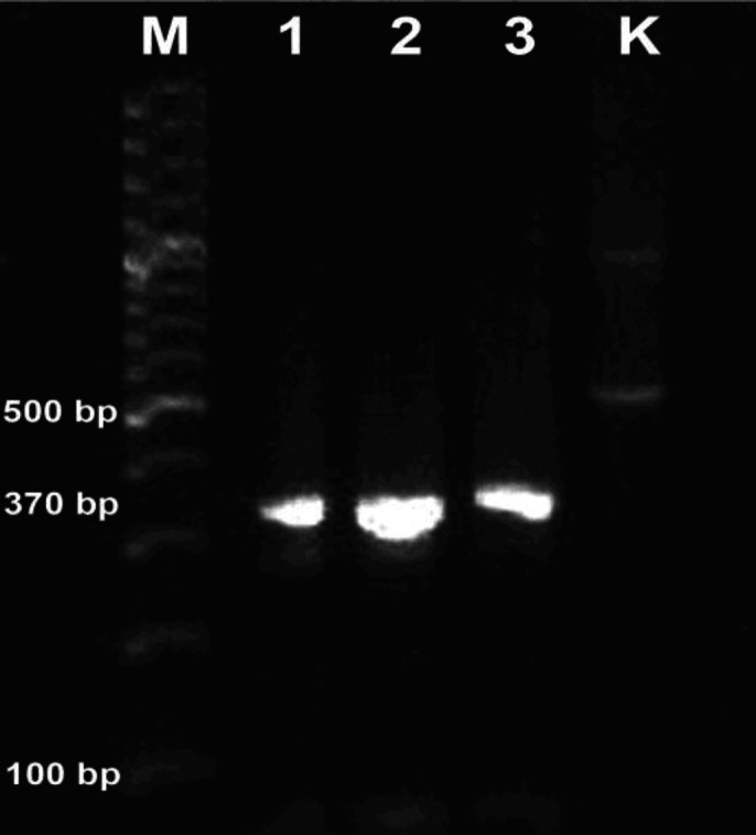 Molecular detection of the <i>beta-lactamase Cefotaxime</i> gene in <i>Escherichia coli</i> from the reproductive tract of Bali cattle with repeat breeder cases on Lombok island.