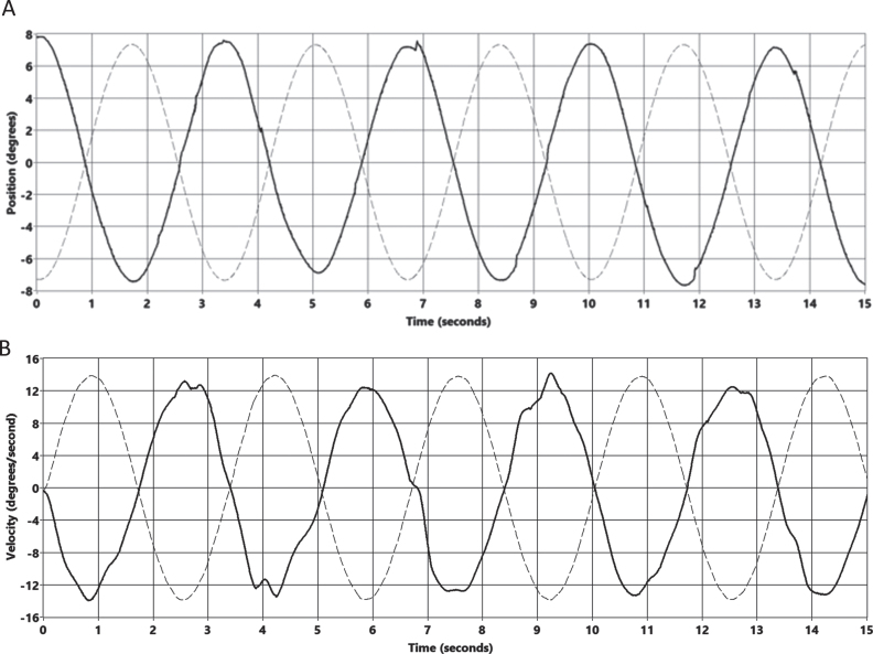 The vertical computerized rotational head impulse test.