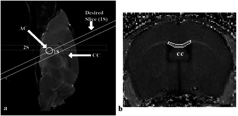 Quantitative Analysis of Early White Matter Damage in Cuprizone Mouse Model of Demyelination Using 7.0 T MRI Multiparametric Approach.
