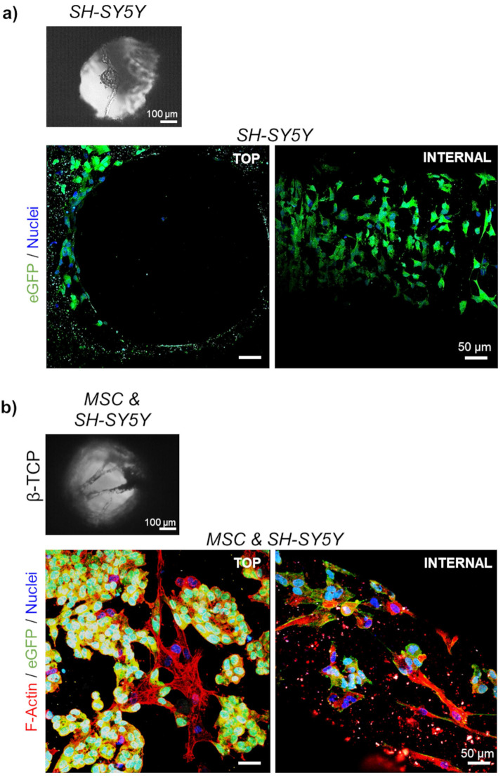 Three-dimensional in vitro model of bone metastases of neuroblastoma as a tool for pharmacological evaluations.