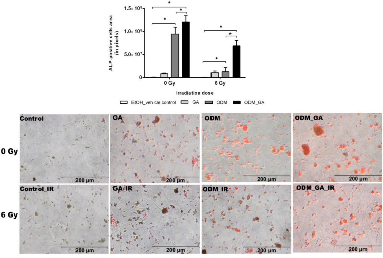 Cytoprotective Effect of Gallic Acid against Injuries Promoted by Therapeutic Ionizing Radiation in Preosteoblast Cells.