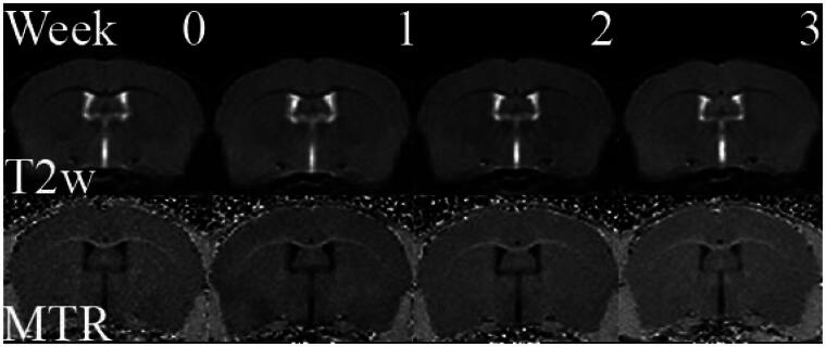 Quantitative Analysis of Early White Matter Damage in Cuprizone Mouse Model of Demyelination Using 7.0 T MRI Multiparametric Approach.