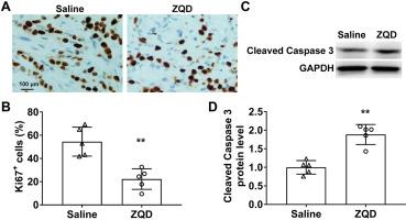 Zhoushi Qi Ling decoction inhibits the progression of castration-resistant prostate cancer in vivo by regulating macrophage infiltration via IL6-STAT3 signaling