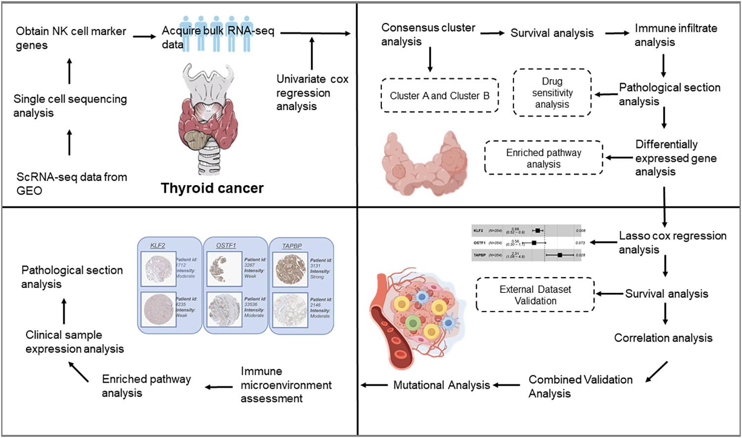 Prognosis and therapy in thyroid cancer by gene signatures related to natural killer cells