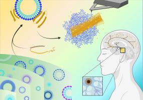 The influence of zwitterionic and anionic phospholipids on protein aggregation