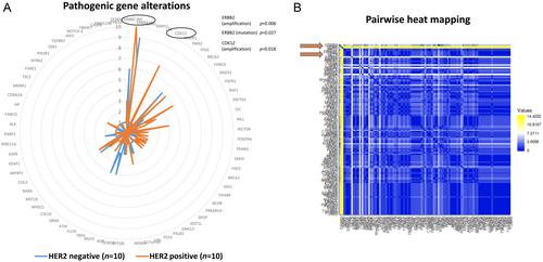 ERBB2-amplified lobular breast carcinoma exhibits concomitant CDK12 co-amplification associated with poor prognostic features