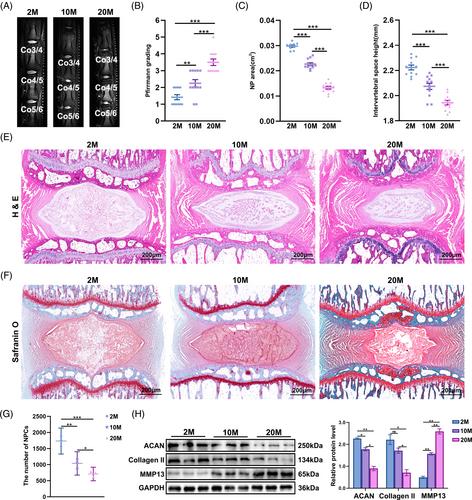 Dynamics of N6-methyladenosine modification during aging and their potential roles in the degeneration of intervertebral disc