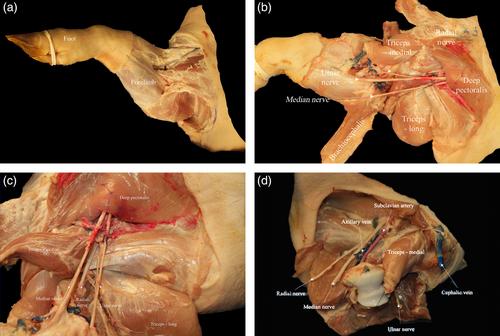 Orthotopic forelimb transplantation in a Yucatan minipig model: Anatomic and in vivo study