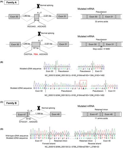 Overcoming challenges associated with identifying FBN1 deep intronic variants through whole-genome sequencing