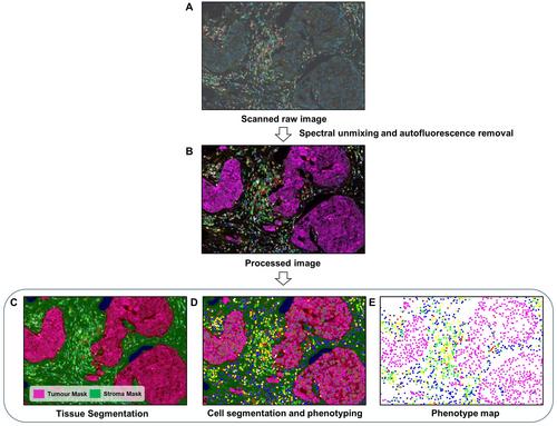 Image-based multiplex immune profiling of cancer tissues: translational implications. A report of the International Immuno-oncology Biomarker Working Group on Breast Cancer