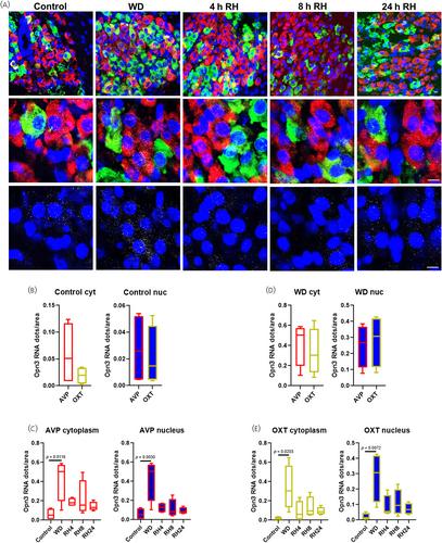 Male rat hypothalamic extraretinal photoreceptor Opsin3 is sensitive to osmotic stimuli and light