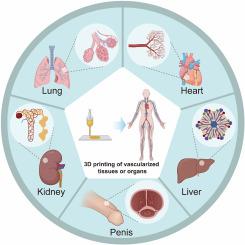 Recent progress of 3D printed vascularized tissues and organs