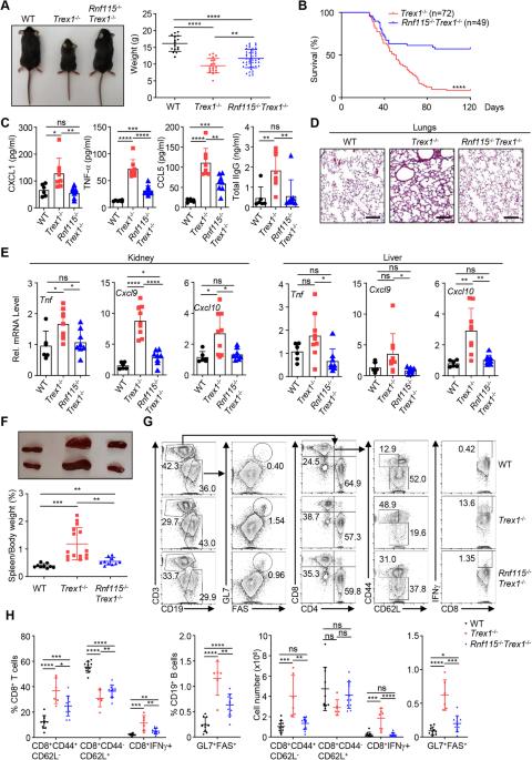 Disulfiram ameliorates STING/MITA-dependent inflammation and autoimmunity by targeting RNF115