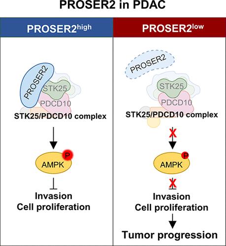 New Function Annotation of PROSER2 in Pancreatic Ductal Adenocarcinoma