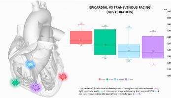 Endocardial pacing compared to epicardial left ventricle pacing and right ventricle pacing: A single-center long-term experience in a pediatric population