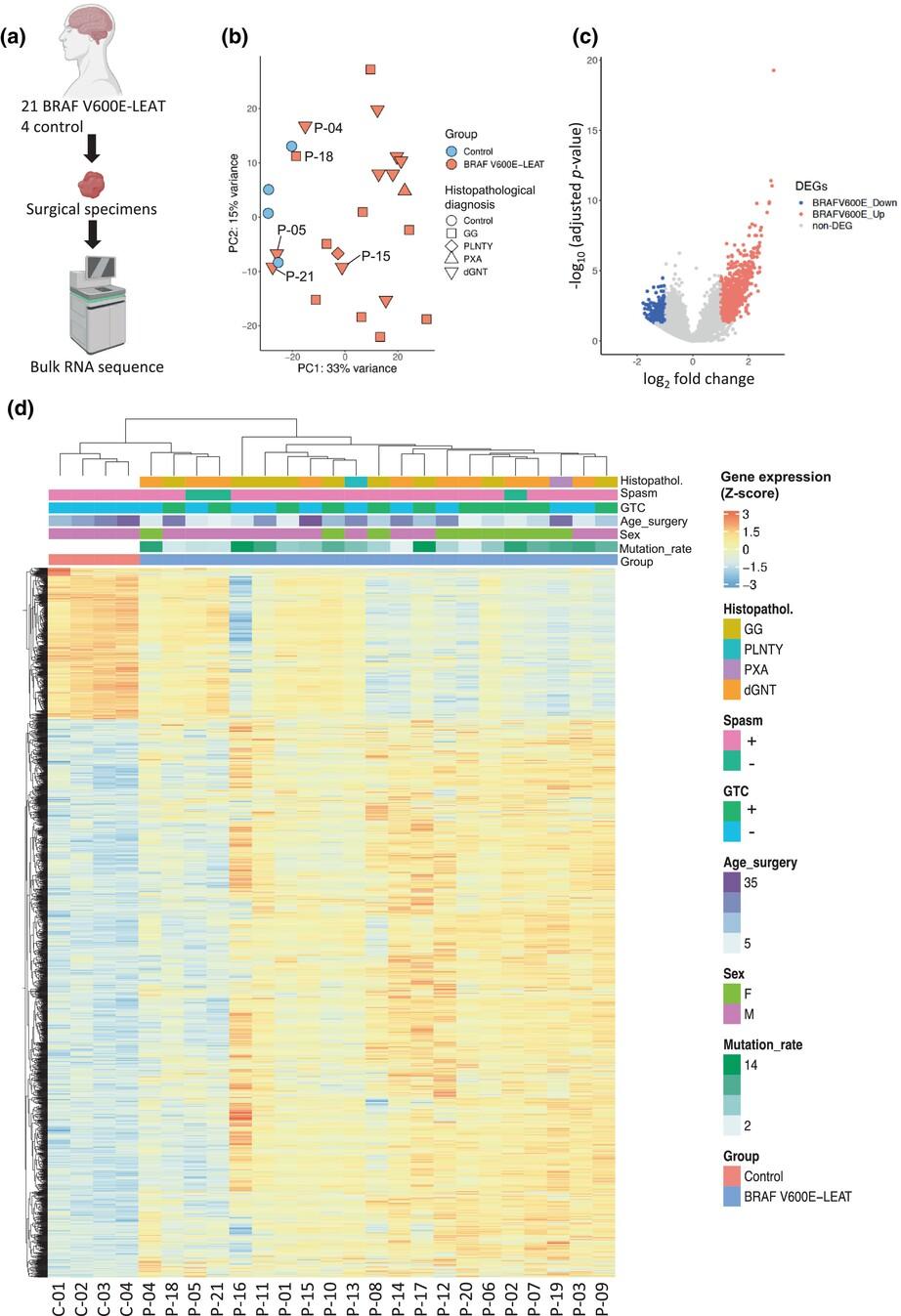 Transcriptional features of low-grade neuroepithelial tumors with the BRAF V600E mutation associated with epileptogenicity