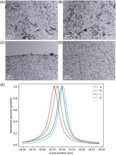 An automated slide scanning system for membrane filter imaging in diagnosis of urogenital schistosomiasis