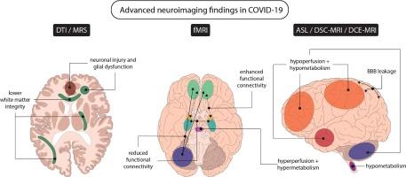 On the merits and potential of advanced neuroimaging techniques in COVID-19: A scoping review