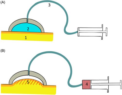 Evaluation of breast skin and tissue stiffness using a non-invasive aspiration device and impact of clinical predictors