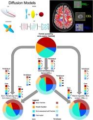 Comparative overview of multi-shell diffusion MRI models to characterize the microstructure of multiple sclerosis lesions and periplaques