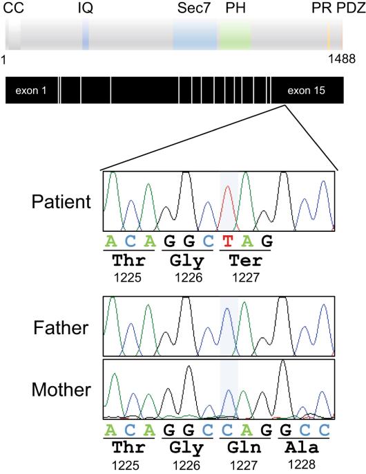 C-terminal truncations in IQSEC2: implications for synaptic localization, guanine nucleotide exchange factor activity, and neurological manifestations