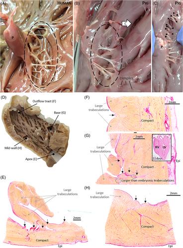 Trabeculations of the porcine and human cardiac ventricles are different in number but similar in total volume