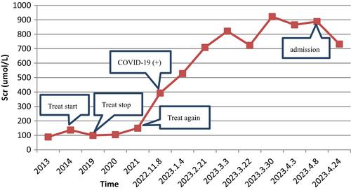 A case of chronic kidney disease patient with rapid deterioration of renal function, hair loss, and spontaneous resolution of facial warts after COVID-19 infection