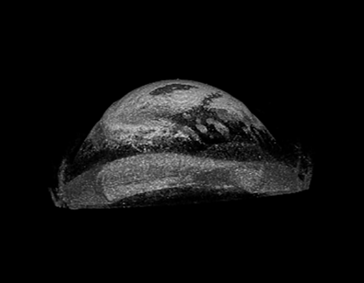 Quantitative assessment of corneal elasticity distribution after FS-LASIK using optical coherence elastography