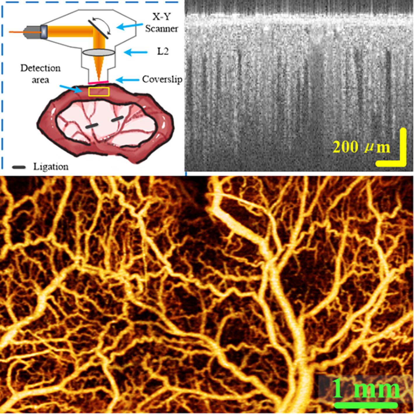 Study of ischemic progression in different intestinal tissue layers during acute intestinal ischemia using swept-source optical coherence tomography angiography