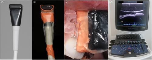 Risk indicators for gingival recession in the esthetic zone: A cross-sectional clinical, tomographic, and ultrasonographic study