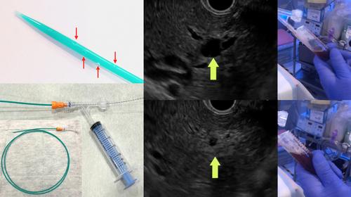 A novel technique for one-step dilation followed by bile aspiration using an ultra-tapered bougie dilator with side holes to minimize bile leakage during EUS-guided hepaticogastrostomy