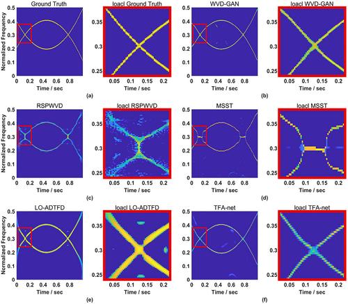 WVD-GAN: A Wigner-Ville distribution enhancement method based on generative adversarial network